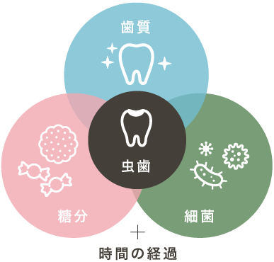 虫歯=歯質+糖分+細菌+時間の経過