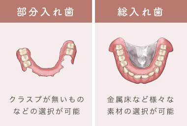 部分入れ歯：クラスプが無いものなどの選択が可能/総入れ歯：金属床など様々な素材の選択が可能