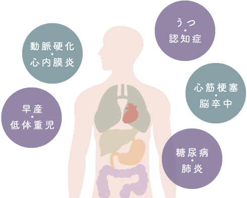 動脈硬化・心内膜炎、うつ・認知症、心筋梗塞・脳卒中、糖尿病・肺炎、早産・低体重児